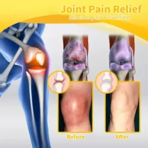 HOOMWELL™ Bee Venom Advanced Joint and Bone Healing Cream